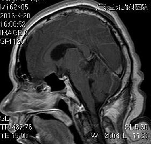 postalcode怎么填(关于Postalcode的填写技巧)