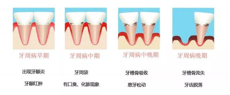 做梦拔牙有什么预兆周公解梦