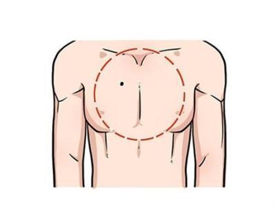 女生胸口中间的痣代表的性格特点，男生胸口中间有痣代表着什么
